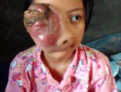 Siti Azmira Dea Nova Butuh Penanganan Rumah Sakit. Semoga Bapak Ridwan Kamil dan Jajarannya Bisa Beri Bantuan Respon Cepat